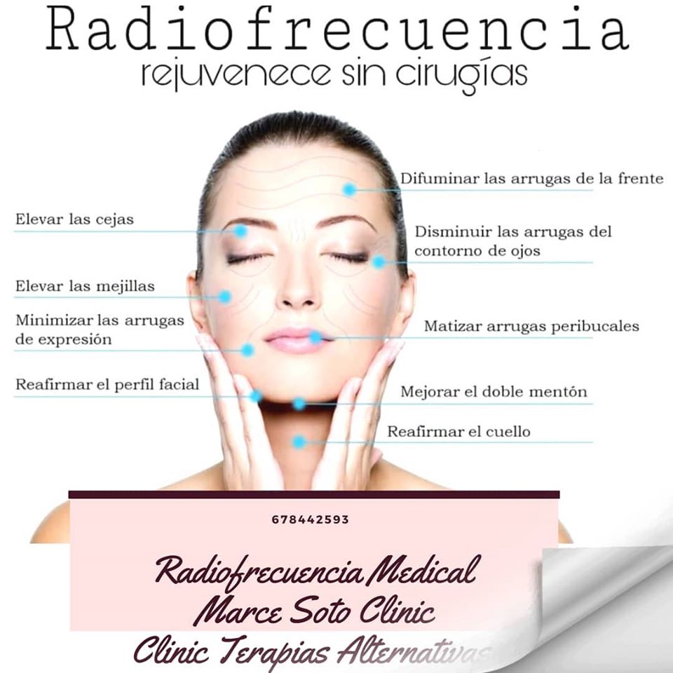 Radiofrecuencia Facial Murcia
